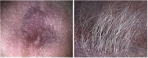 Skin cells from adult mice do not form hairs. We can environmentally reprogram them to form hairs.