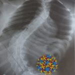 Glass beads embroidered on xray, 16"x13"