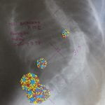 Glass beads embroidered on xray, 16"x13"